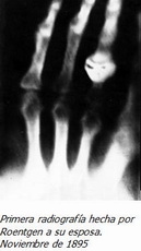 Primera Radiografia en noviembre de 1895